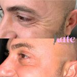 before & after