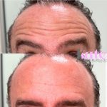 before & after(1)