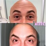 before & after(2)